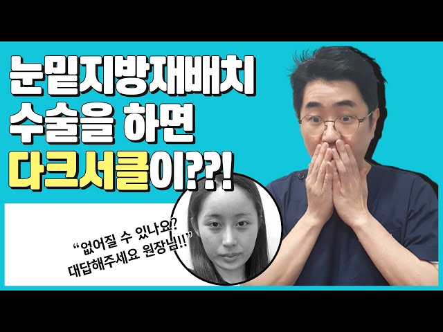 눈밑지방재배치 하면 다크서클이??