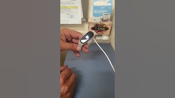 Xiaomi mi band 8 pantalla táctil no funciona