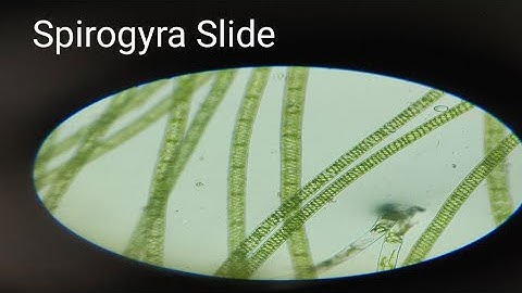 preprations of  Spirogyra Slide  alge slide Fresh water alge