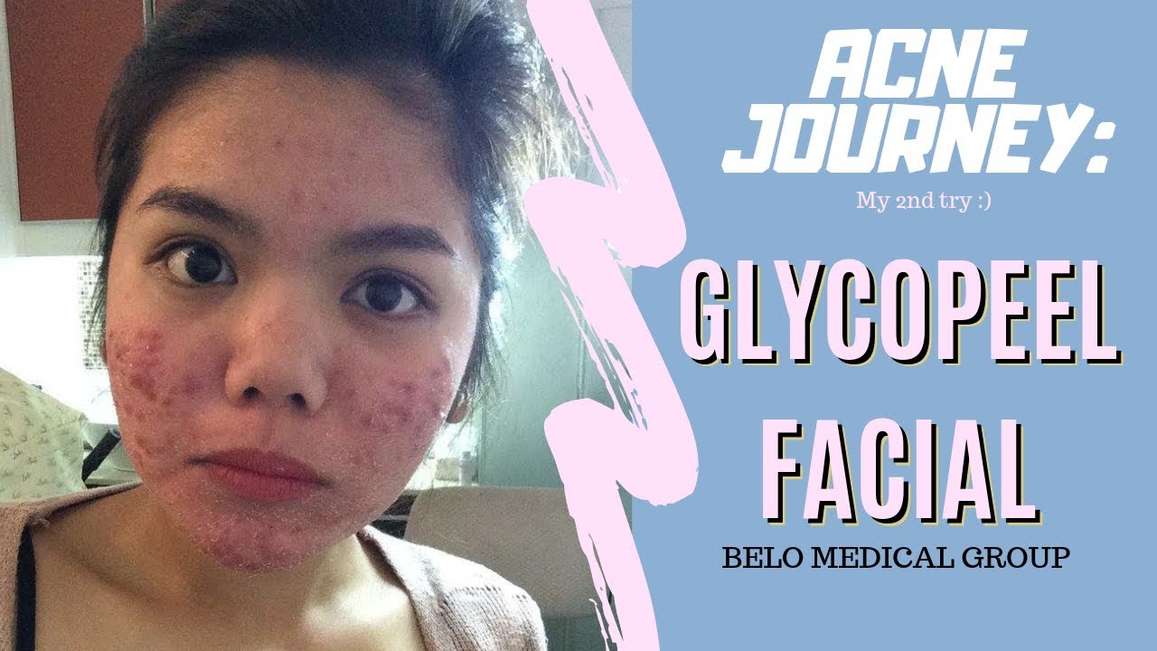 glycopeel