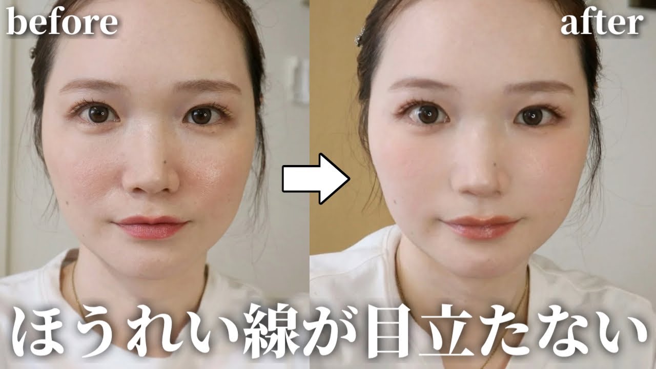 “目元のシワ、ほうれい線、口元のカサつきが気になる方 !ビューテックポイント ほうれい線は2種類「深い」「強い」に分類される。対策と改善方法は