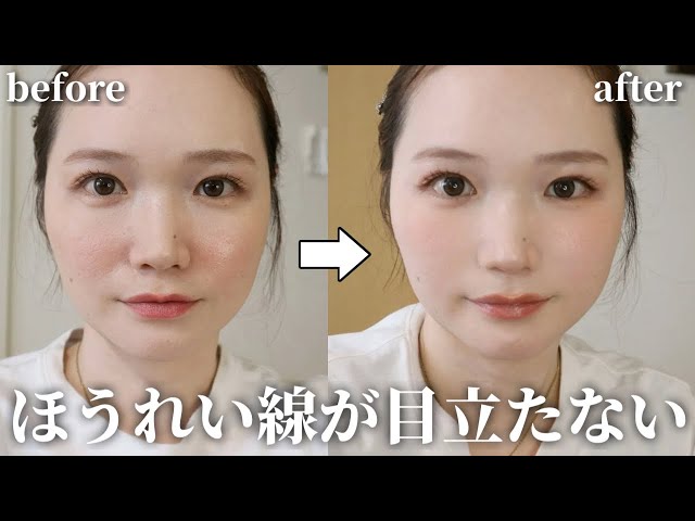Plastic Surgery Level] A divine technique to erase wrinkles in