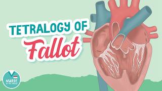 Tetralogy of Fallot » Pediatrics Help for Nursing Students
