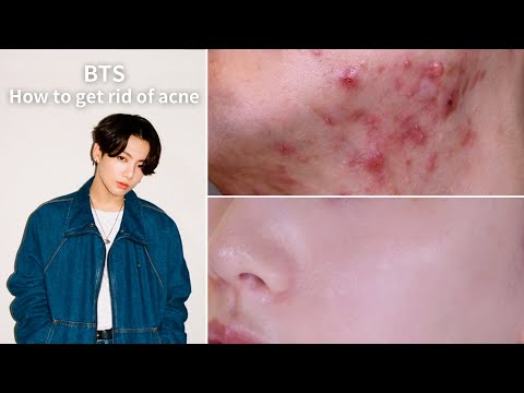 BTS 정국의 여드름 없애는 사과식초 세안법🍎블랙헤드 제거 가능 / Jungkook’s Secret Skin Care Tips