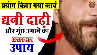 घनी दाढ़ी और मूंछ उगाने का असरदार उपाय | How Fix Patchy Beard & increase hair facial hair Grow