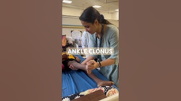 ANKLE CLONUS (CNS Examination) #mbbs #paediatrics #examination #shortvideo