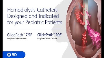 BD GlidePath™ 7.5F and 10F Long-Term Hemodialysis Catheter Procedural Animation (no audio)