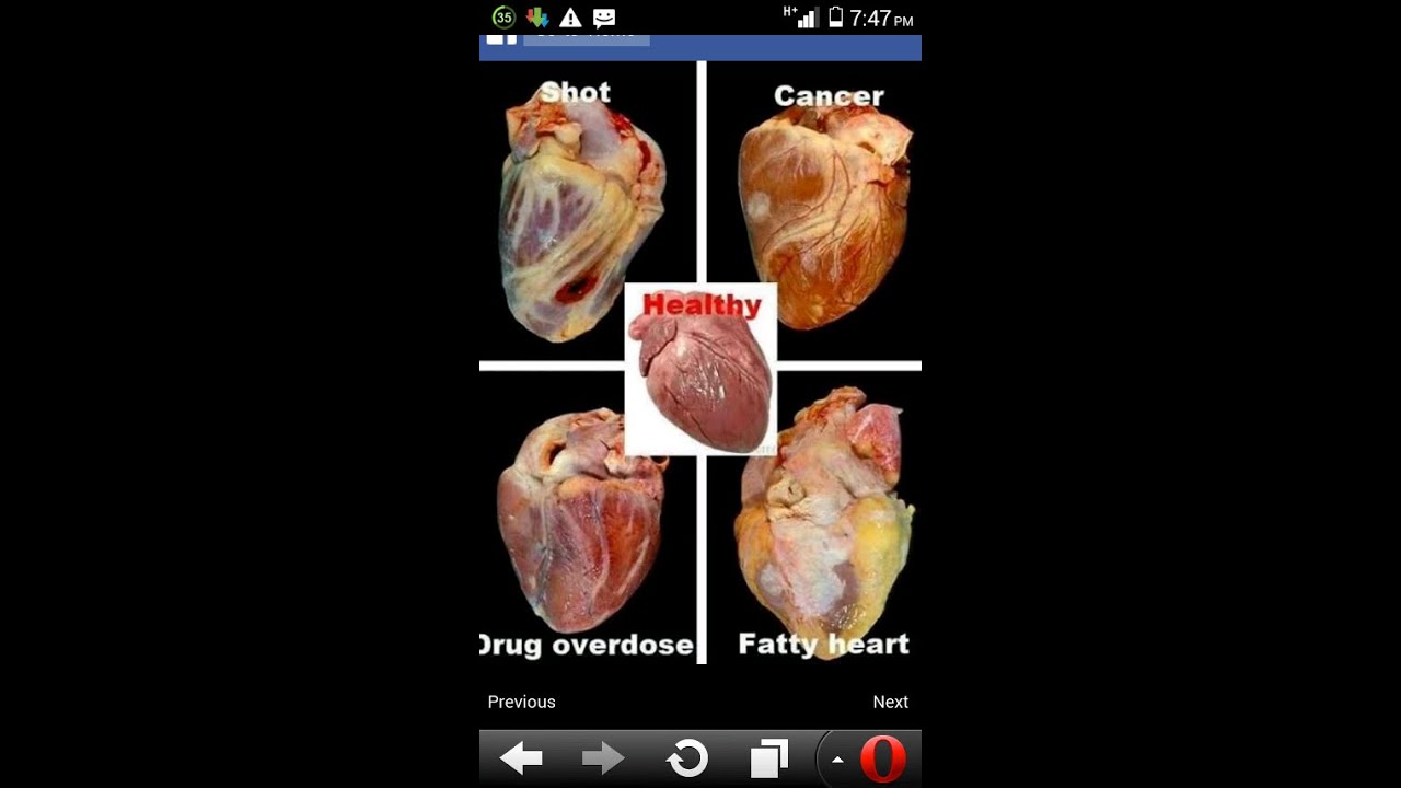 10 Awesome things about Blood type  A    Personality &amp; Behaviour !!   YouTube 720p