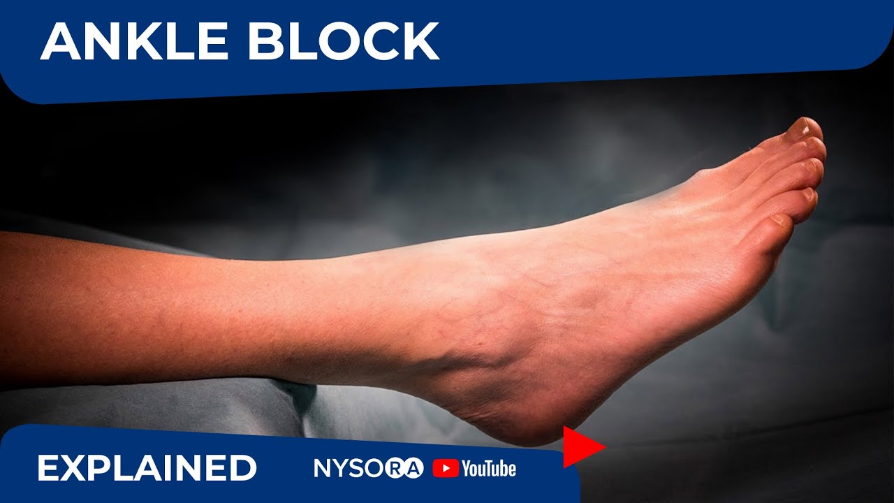 Nerve Blocks of the Hand and Wrist — Downeast Emergency Medicine