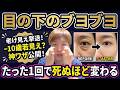 【40代以降必見】パンパンな目袋スッキリ！老け見え原因「眼窩脂肪」戻す神ワザ