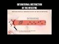 How obturational obstruction of intestine occurs? #obstruction #intestine #abdominalpain #surgery
