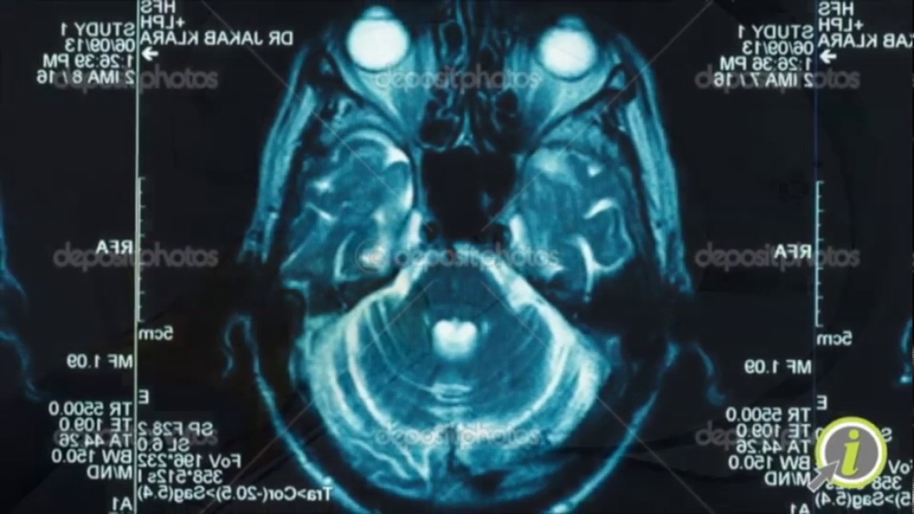 Degetau MRI & CT - YouTube