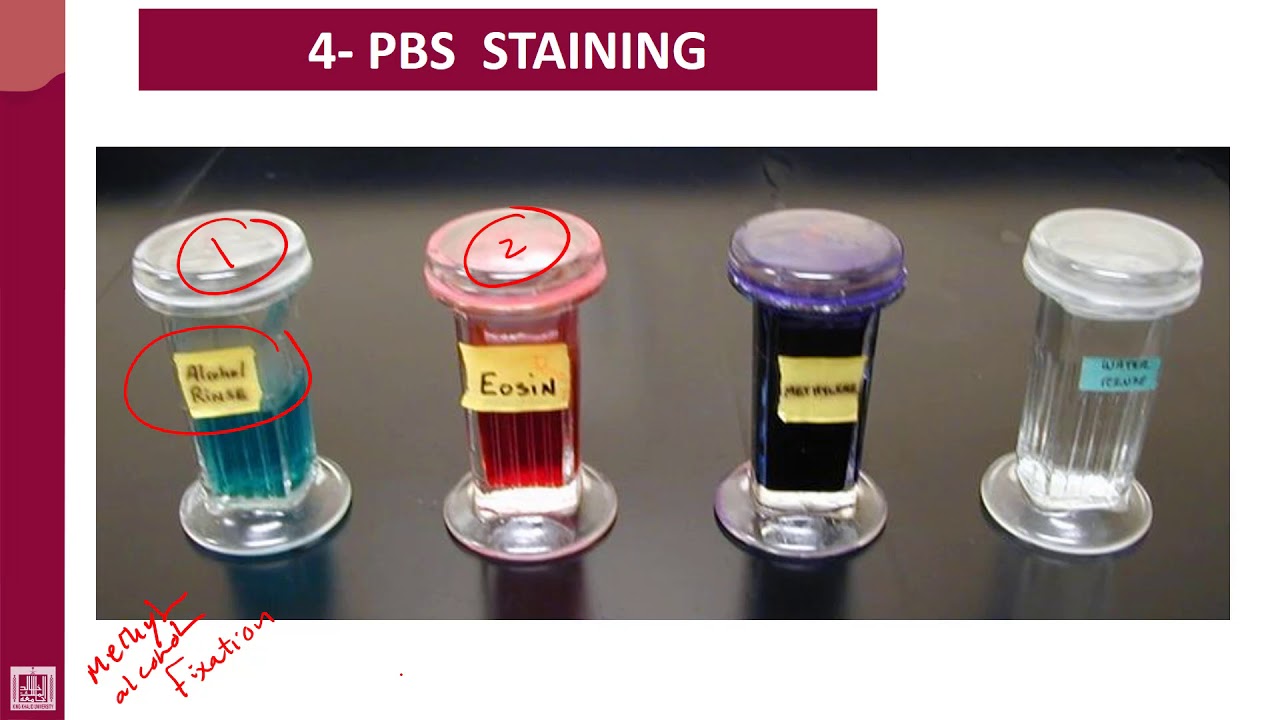Hematology 1 U1L6 Blood film staining YouTube