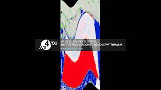 Super Mario Galaxy Game Overs in Wat Twirl screenshot 5