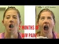 Unbelievable Chronic * TMJ/Jaw Pain * RELIEVED In No Time (THIS WORKS!!!)