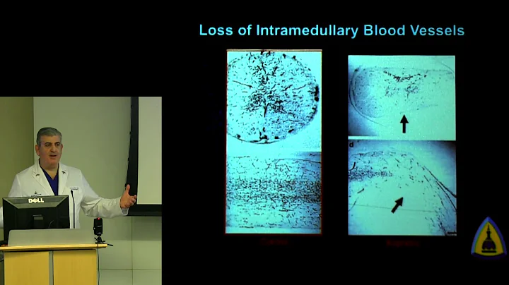 "Novel Concepts in Spinal Cord Pathophysiology" - ...
