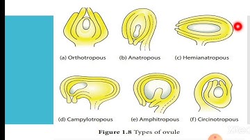 Types of ovule Botany practical by Dr Sulekha Joshi