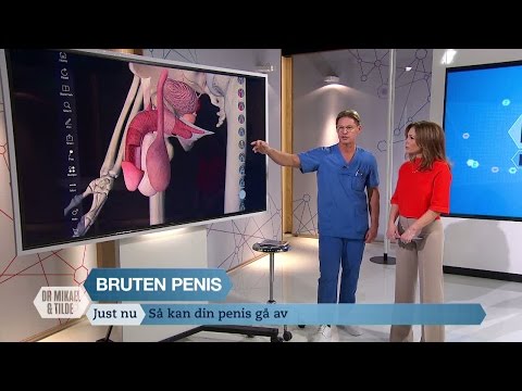 Video: Øm Penis Efter Sex: 11 årsager, Andre Symptomer Og Behandling