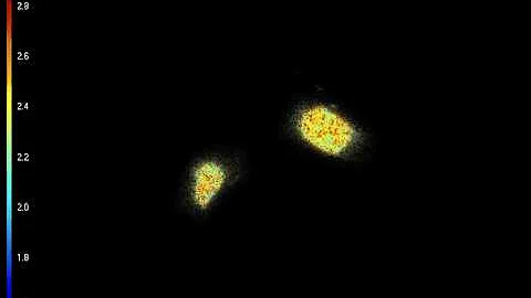YFP-Transfected Cells Fluorescence Lifetime Spinning Disk
