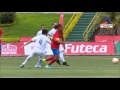 Ronaldinho en Guatemala: Clásico de la Alegría, Comunicaciones vs. Municipal