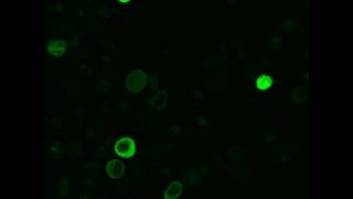 NF-kappaB dynamics in a multiple myeloma cell line
