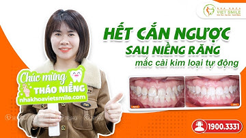 Hết cắn ngược sau niềng răng mắc cài kim loại tự động - KH Đinh Thị Thủy CG3660