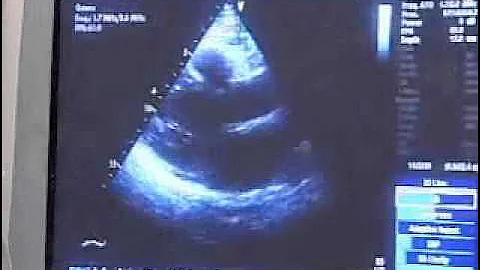 Cardiovascular Award - HealthWatch