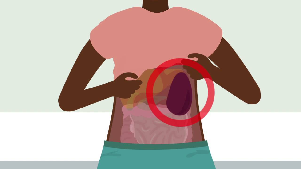 What are some symptoms of an enlarged spleen?