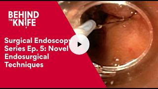 Surgical Endoscopy Series Ep. 5: Novel Endosurgical Techniques