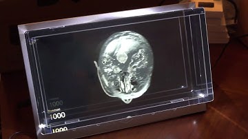 DICOM Viewer in 3D Volumetric display