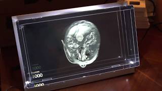 DICOM Viewer in 3D Volumetric display screenshot 4