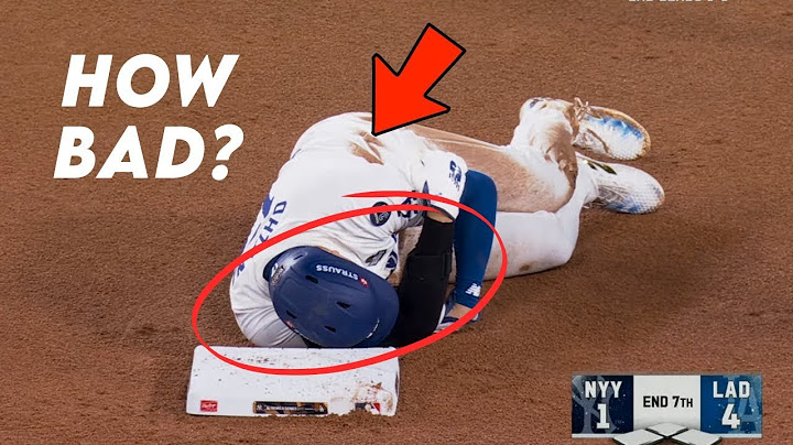 "Yankees vs. Dodgers World Series Game 2 Highlights: Shocking Injury to Star Player!"