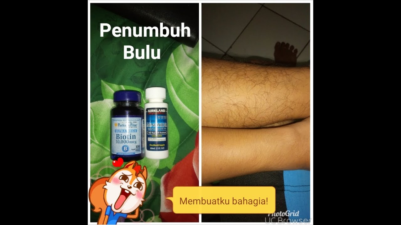 Wow!!! Ternyata Ini Dia Cara Ampuh Menumbuhkan Bulu Betis, Tangan & Jambang Order Via Wa:08989115758 - Youtube