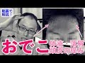 こんなところに原因が！頭皮や髪の生え際のかゆみの原因【動画アドバイス】