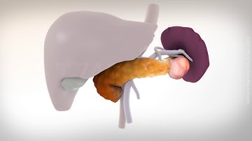 Laparoscopic distal pancreatectomy