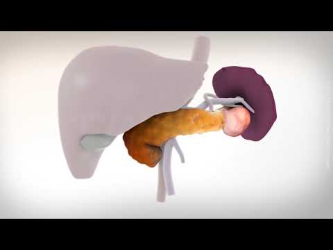 Video: Ce înseamnă pancreatectomizare?