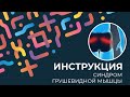 Kinexib - тейпирование синдрома грушевидной мышцы