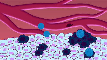 How Do Doctors Target Diseased Cells?