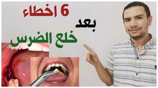 6 اخطاء بعد خلع الضرس لا تفعلها ابدا