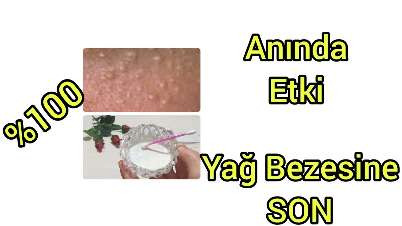 100 Etki Goz Alti Yag Bezelerine En Hizli Cozum Sipsak Etki Limonla Yag Bezeleri Tariflerini Unutun Youtube