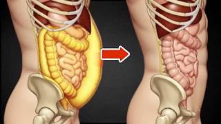 Cara Menurunkan Lemak Visceral dengan Cepat & Alami screenshot 5