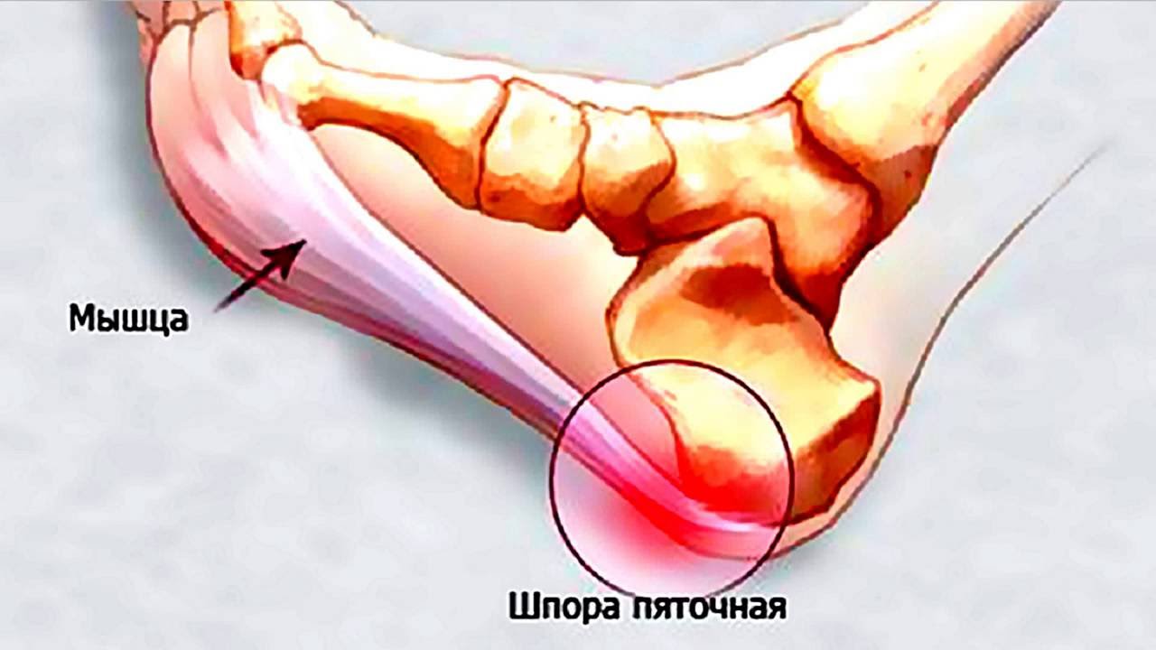 Опасные моменты