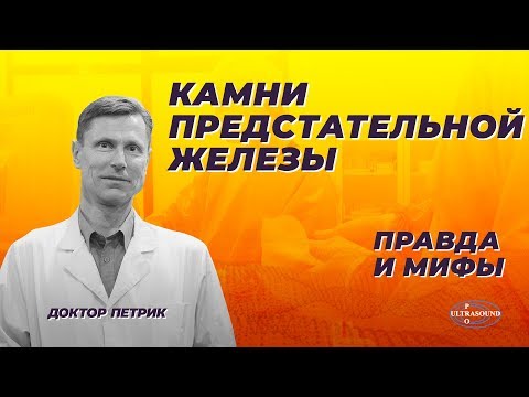 Камни предстательной железы. Правда и мифы.