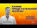 Камни предстательной железы. Правда и мифы.