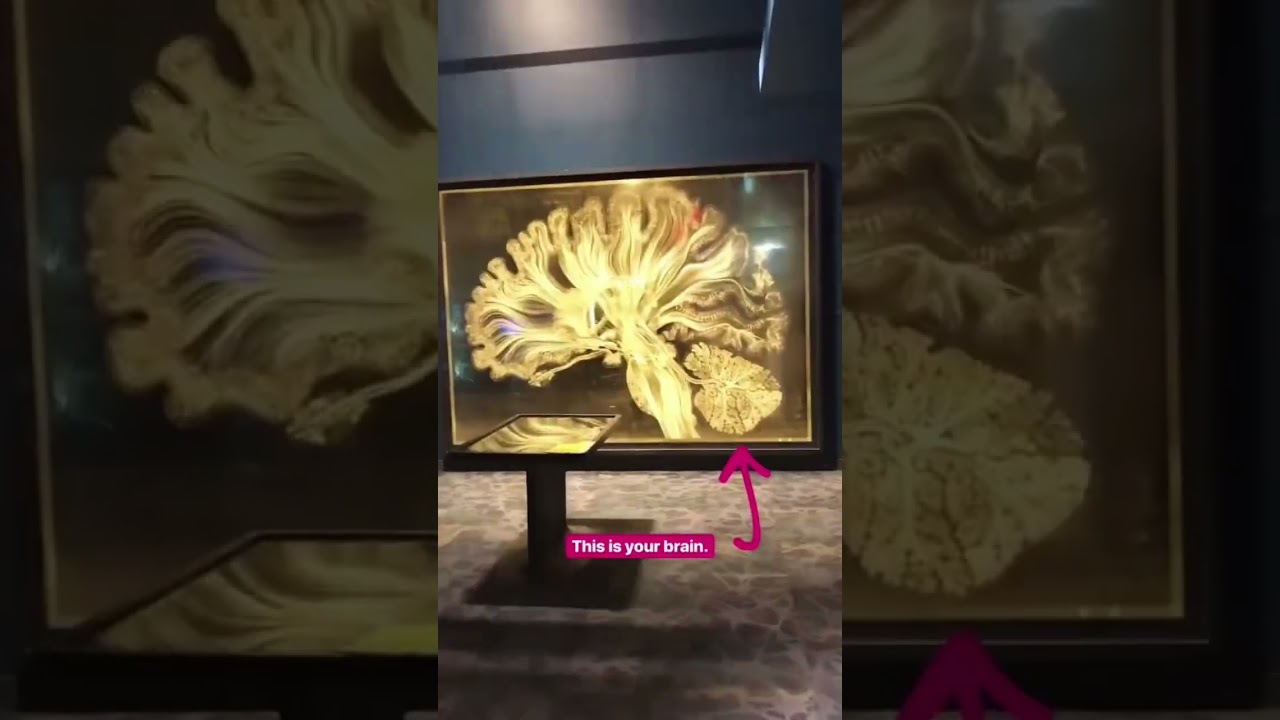 Brain Display at the Franklin Institute 