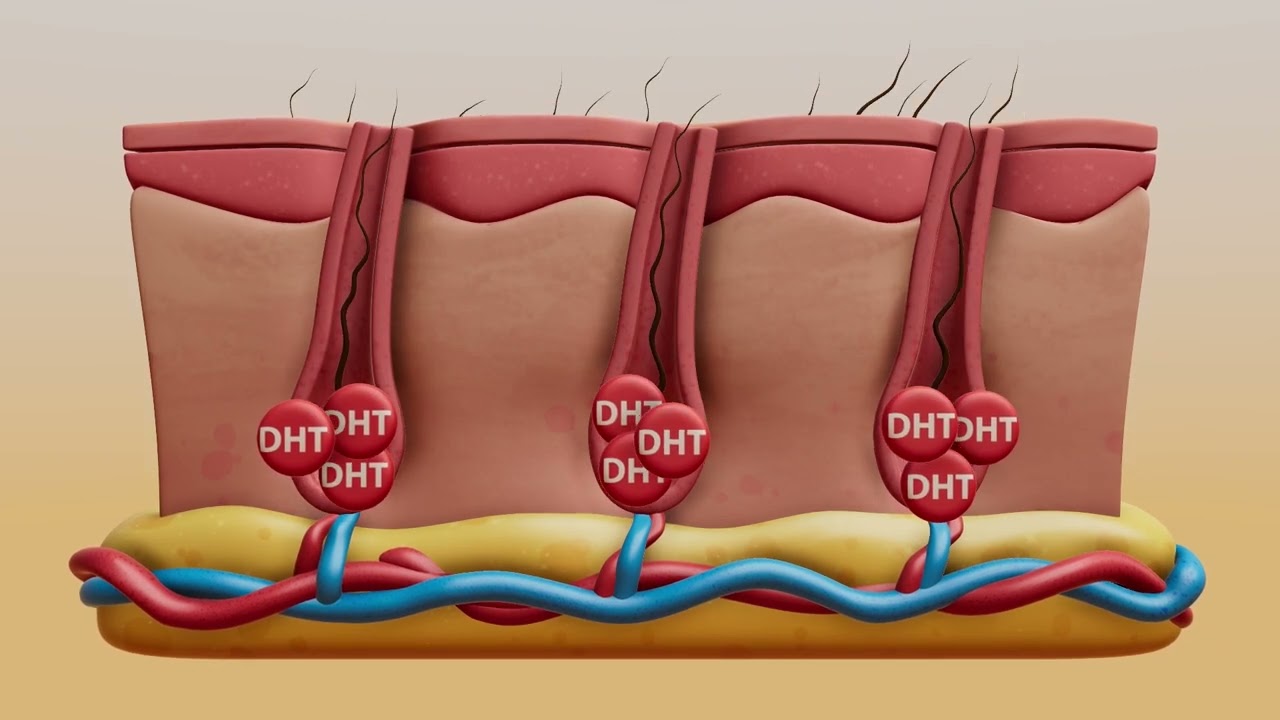 How Does Laser Hair Therapy Regrow Your Hair?