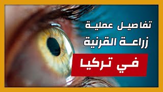 عملية زراعة القرنية