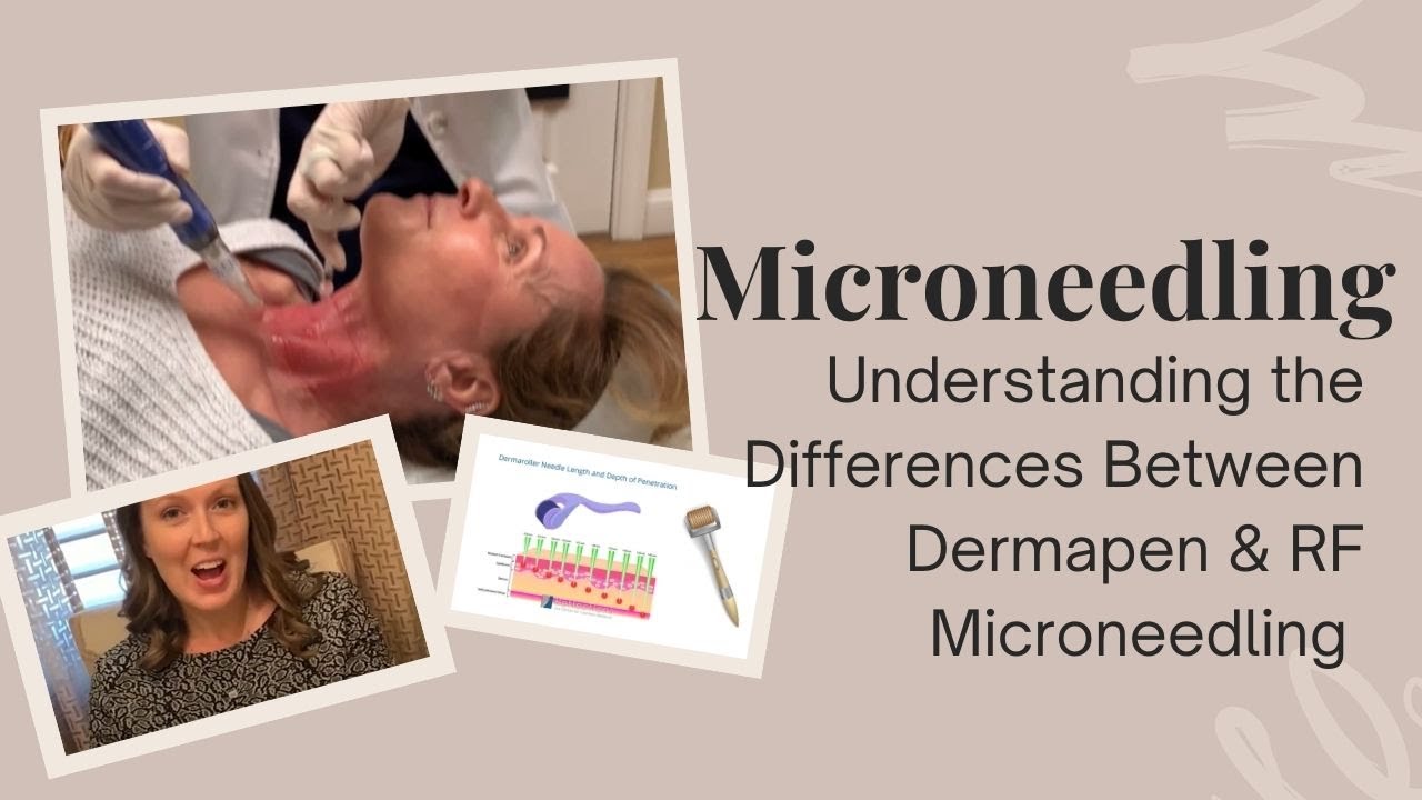 Best Microneedling Treatments Specials Near Me Nj Price Cost