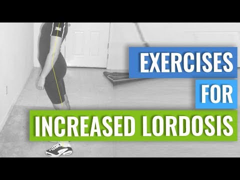 Exercises to Correct Hyperlordosis in the Lumbar Spine