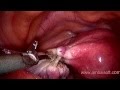 HD video